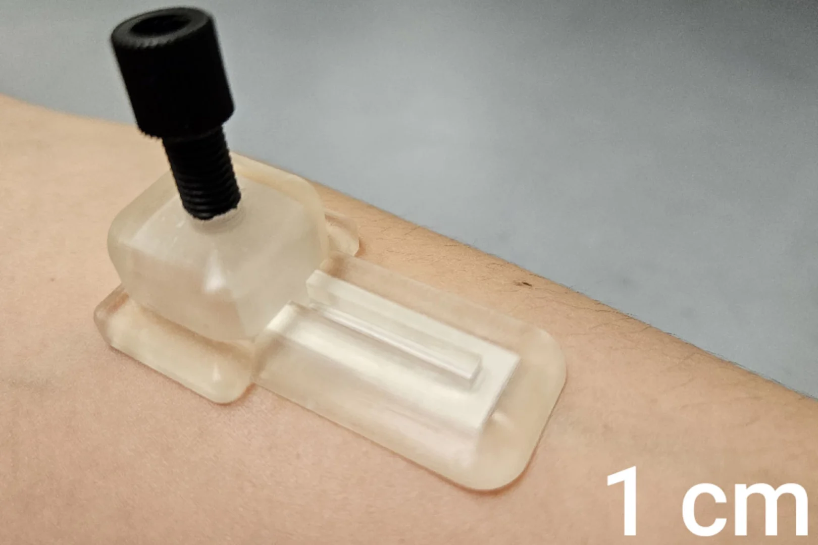 Smart skin patch