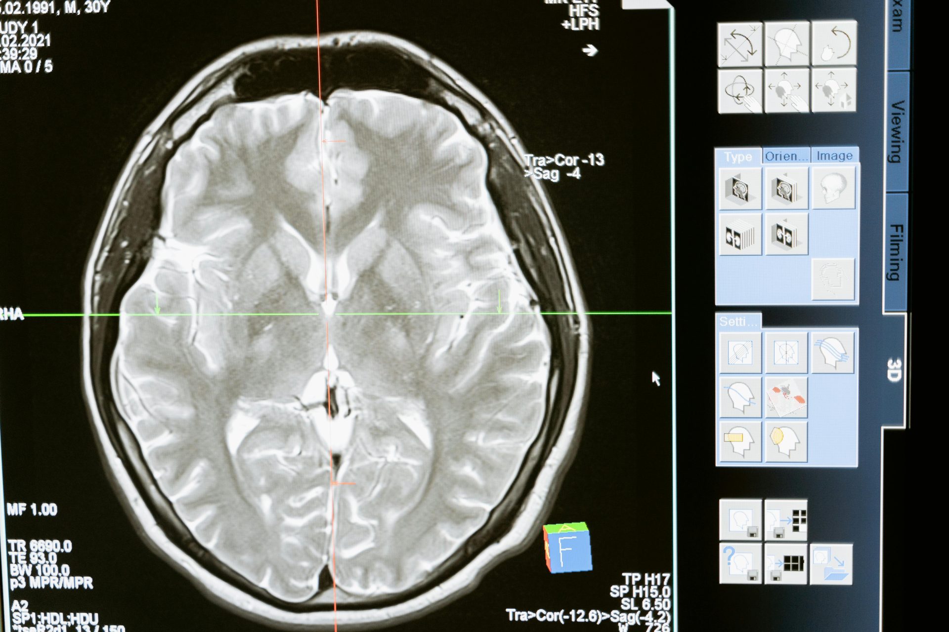 Brain