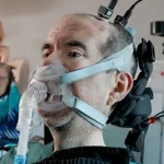BrainGate 2