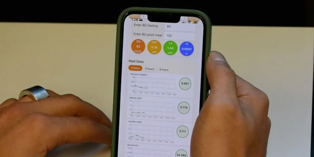 นักวิจัยพัฒนาแหวนต้นแบบ ตรวจน้ำตาล-คีโตนจากเหงื่อ ส่งข้อมูลเข้า iPhone ได้ทันที